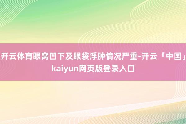 开云体育眼窝凹下及眼袋浮肿情况严重-开云「中国」kaiyun网页版登录入口